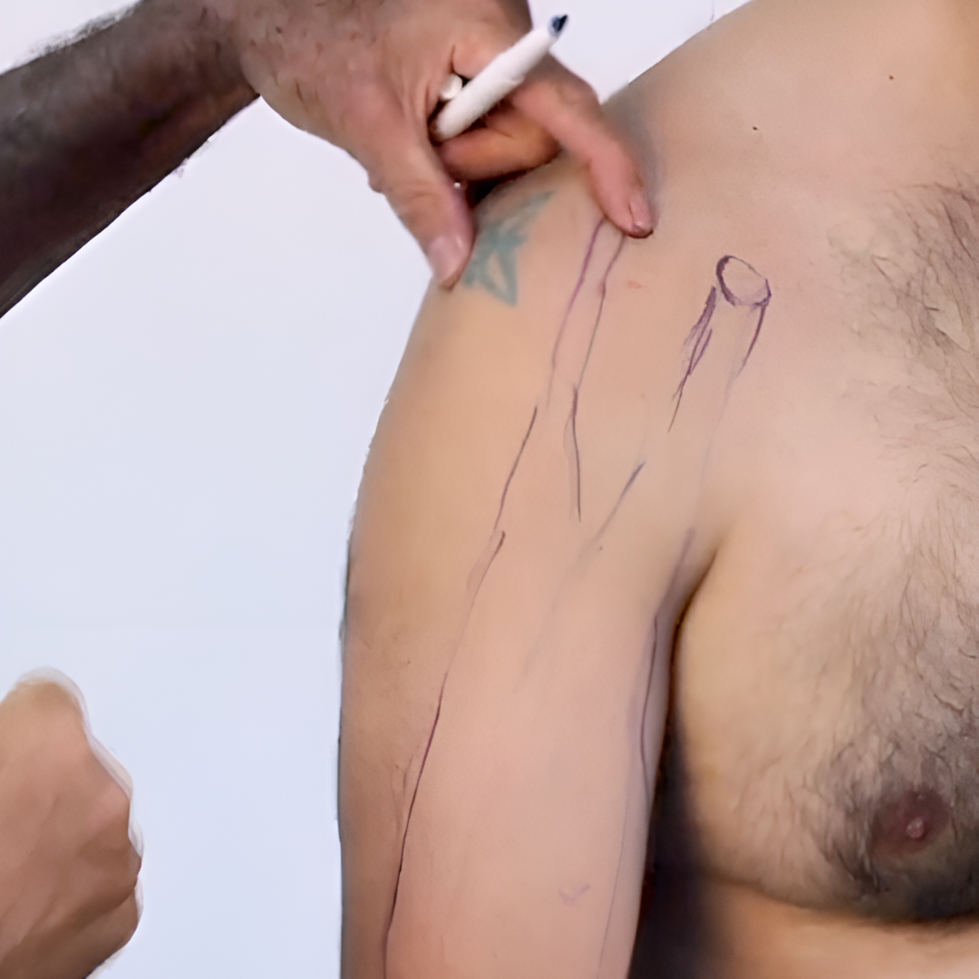 NAT Treating Elbow and Wrist Injuries - 2.5 CE Hours