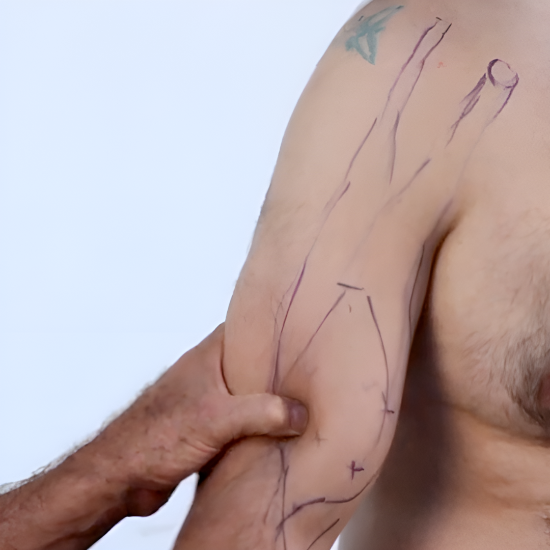 NAT Treating Elbow and Wrist Injuries - 2.5 CE Hours