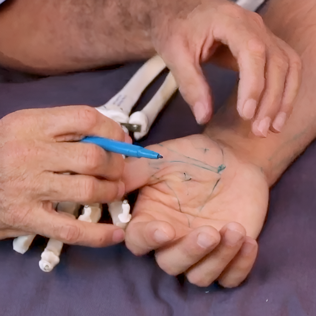 NAT Treating Elbow and Wrist Injuries - 2.5 CE Hours