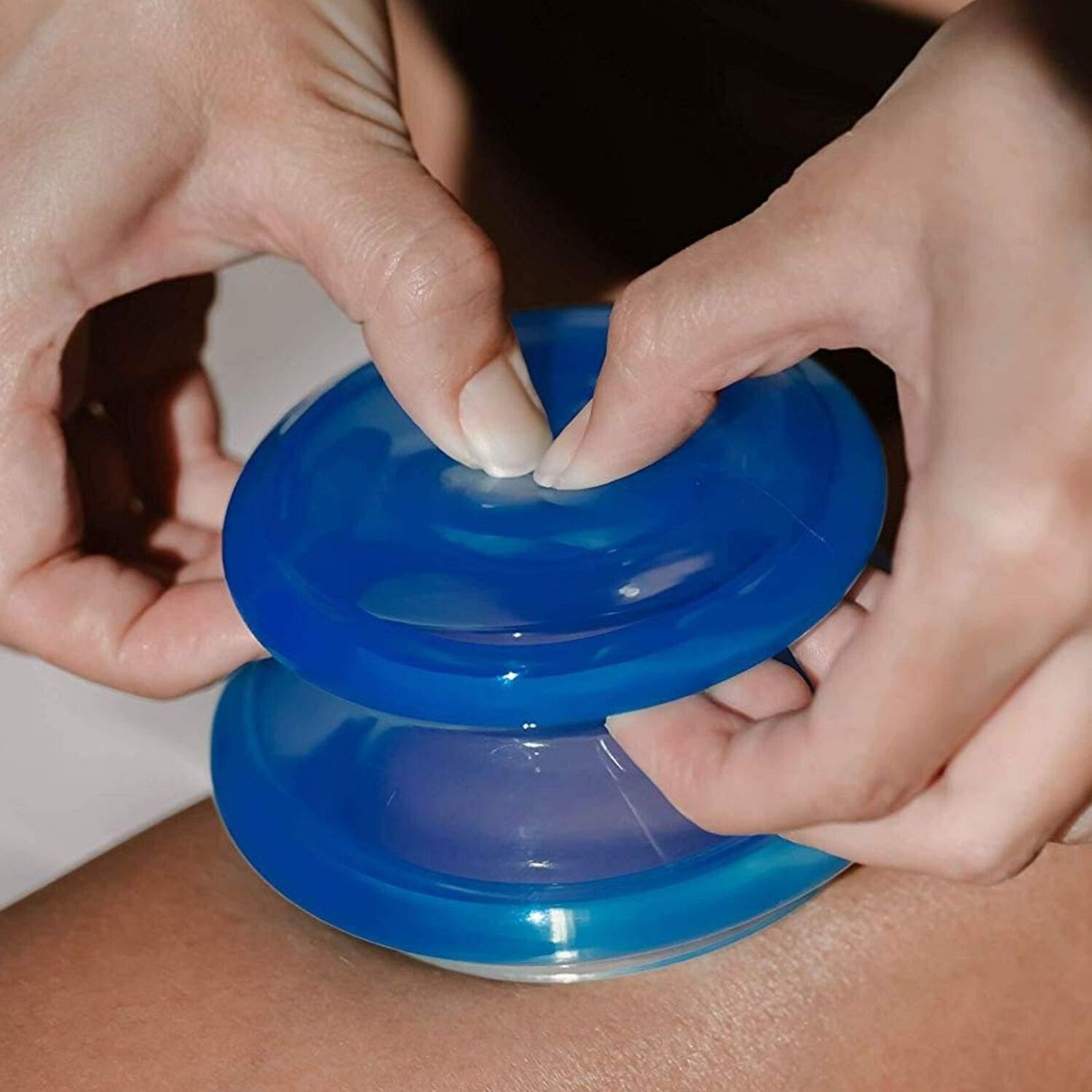 EDGE™ Cupping Therapy Set Blue, 4 Cups