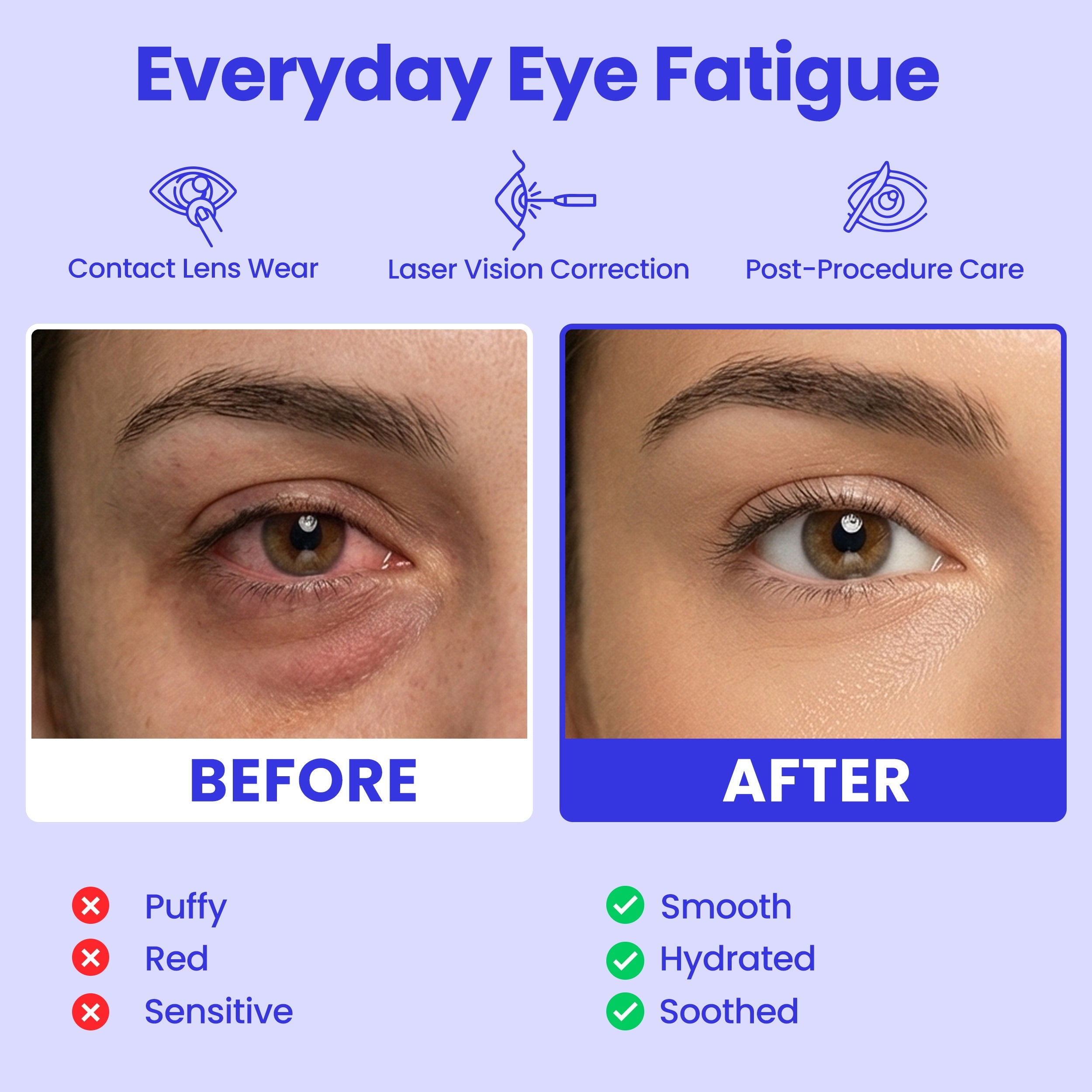 Eye Serenity Steam Eye Mask - Self-Heating Warm Eye Compress for Dry Eyes, Puffiness, Sleep & Travel