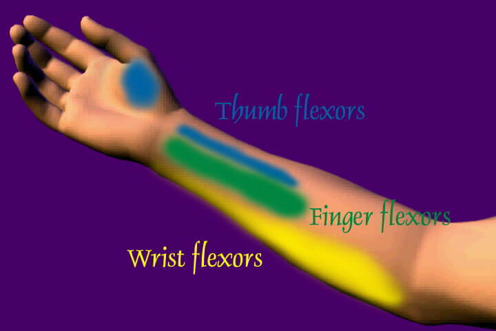 Heal Your Wrist Pain Video On DVD & Streaming Version - Real Bodywork