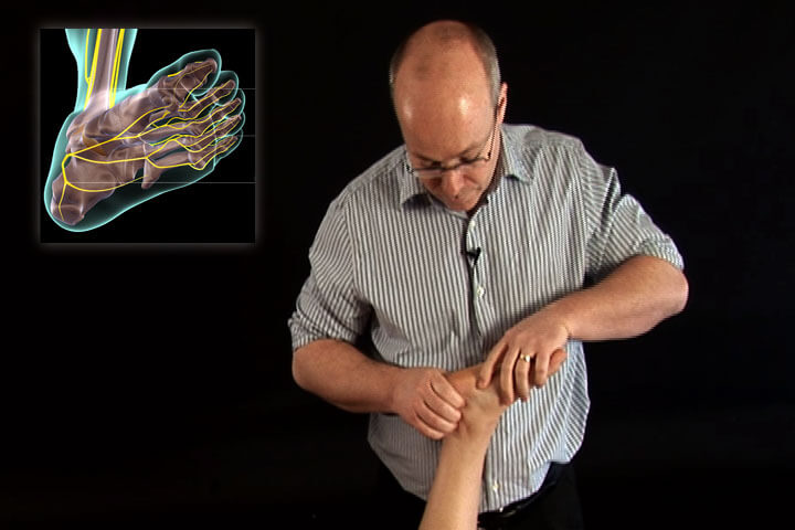 Nerve Mobilization The Lower Body Video on DVD & Streaming Version - Real Bodywork