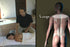 Clinical Shiatsu & Acupressure Massage Video on DVD - Real Bodywork